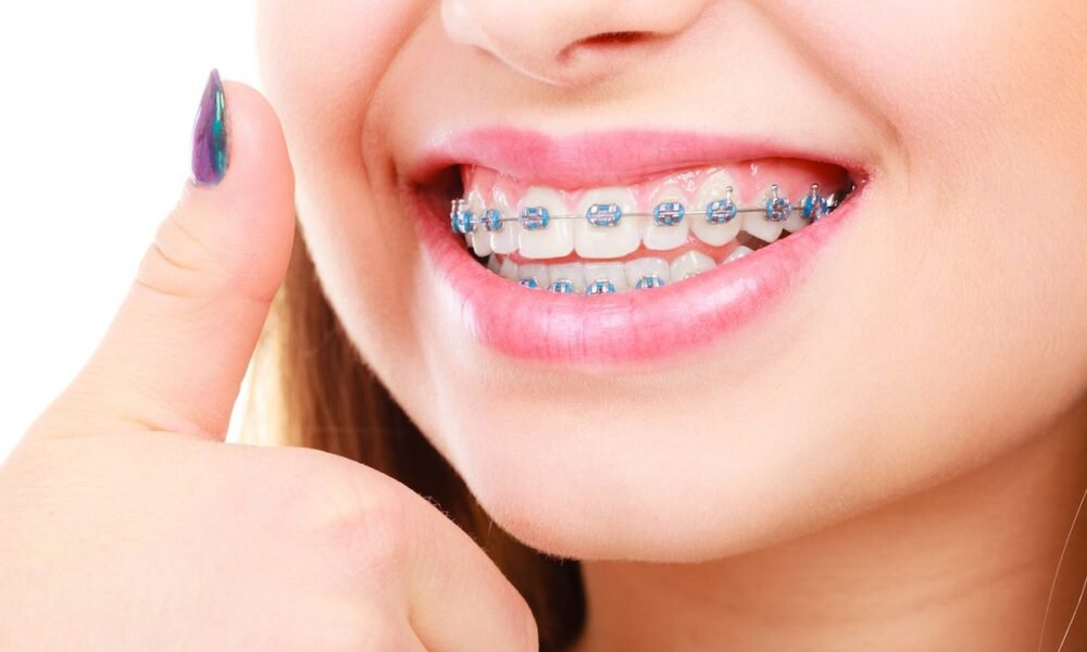 تقويم الاسنان فى تبوك