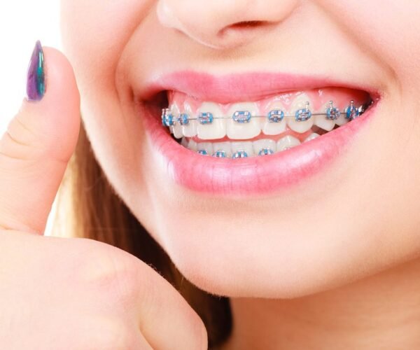 تقويم الاسنان فى تبوك