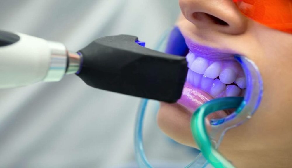 طرق تبييض الاسنان فى تبوك - مجمع العناية المتميزة الطبى فى تبوك