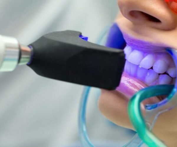 طرق تبييض الاسنان فى تبوك - مجمع العناية المتميزة الطبى فى تبوك